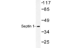 Image no. 1 for anti-Septin 1 (SEPT1) antibody (ABIN272245) (Septin 1 Antikörper)