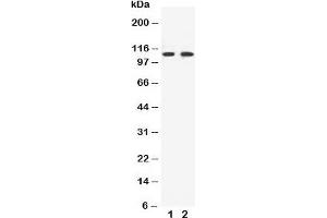 Western blot testing of EphB3 antibody and Lane 1:  HeLa;  2: A549 cell lysate (EPH Receptor B3 Antikörper  (C-Term))