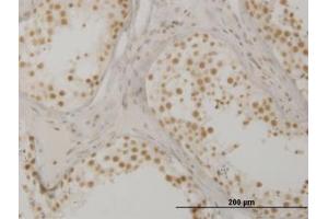 Image no. 1 for anti-Oxidative-Stress Responsive 1 (OXSR1) (AA 351-450) antibody (ABIN599103) (OXSR1 Antikörper  (AA 351-450))