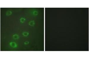 Immunofluorescence analysis of HuvEc cells, using PTX3 Antibody.