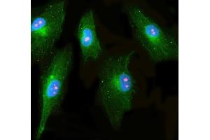 IF analysis of RRP1 and Tubulin beta using anti-RRP1 antibody (ABIN7600683) and anti-Tubulin beta antibody (ABIN7602744).