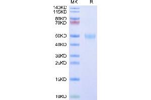 SDS-PAGE (SDS) image for Receptor Tyrosine Kinase-Like Orphan Receptor 1 (ROR1) (AA 30-305) protein (His tag) (ABIN7275529)