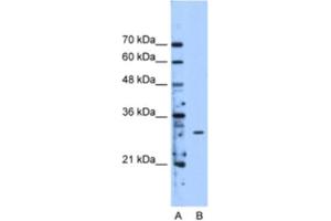 Western Blotting (WB) image for anti-Methyltransferase Like 1 (METTL1) antibody (ABIN2463199) (METTL1 Antikörper)