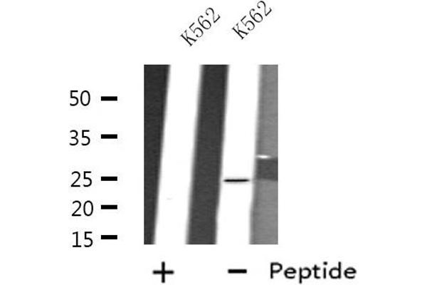 FEV anticorps  (N-Term)