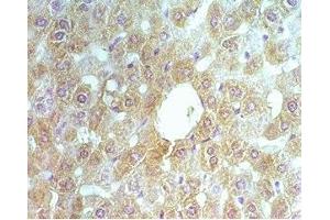 Rat liver tissue was stained by rabbit Anti-ABCB6 (260-301) (Human, Mouse ) Serum (ENPP2 Antikörper  (AA 369-391))
