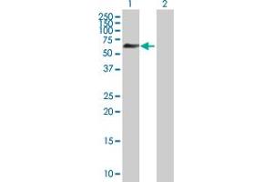 Western Blot analysis of ZNF446 expression in transfected 293T cell line by ZNF446 MaxPab polyclonal antibody. (ZNF446 Antikörper  (AA 1-450))