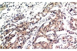 Immunohistochemistry (Paraffin-embedded Sections) (IHC (p)) image for anti-Ubiquitin (Ub) antibody (ABIN7250323)