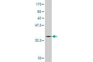 Western Blot detection against Immunogen (36. (CNOT2 Antikörper  (AA 441-540))