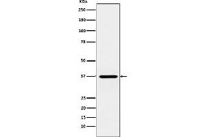 Western blot analysis of CRX expression in Y79 cell lysate.