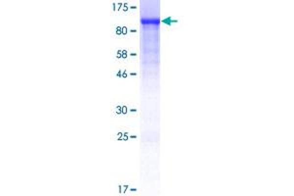 Caldesmon Protein (AA 1-538) (GST tag)