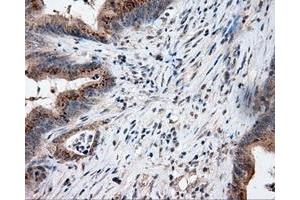 Immunohistochemical staining of paraffin-embedded Kidney tissue using anti-LIPG mouse monoclonal antibody. (LIPG Antikörper)