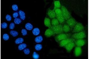 anti-Grainyhead-Like 1 (GRHL1) (AA 1-618) antibody