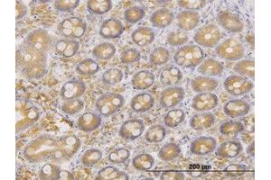 Image no. 1 for anti-ERO1-Like Protein alpha (ERO1L) (AA 90-179) antibody (ABIN599232) (ERO1L Antikörper  (AA 90-179))