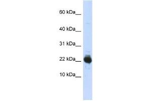 UBE2L3 antibody used at 1 ug/ml to detect target protein. (UBE2L3 Antikörper  (Middle Region))