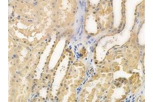 ABIN6258339 and ABIN6275792 at 1/100 staining human normal kidney tissue by IHC-P.