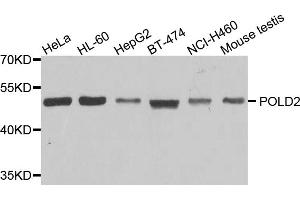 Western blot analysis of extracts of various cell lines, using POLD2 antibody. (POLD2 Antikörper)
