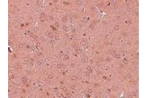 Immunohistochemistry (IHC) image for anti-Golgi Membrane Protein 1 (GOLM1) (Middle Region) antibody (ABIN1030941) (GOLM1 Antikörper  (Middle Region))