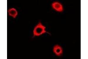 Immunofluorescent analysis of Rac 1 staining in A549 cells. (RAC1 Antikörper)