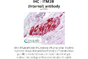 Image no. 1 for anti-Integral Membrane Protein 2B (ITM2B) (Internal Region) antibody (ABIN1736083) (ITM2B Antikörper  (Internal Region))