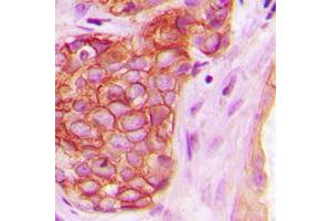 Immunohistochemistry (IHC) image for anti-Protein Kinase D1 (PRKD1) (pTyr463) antibody (ABIN7301158)