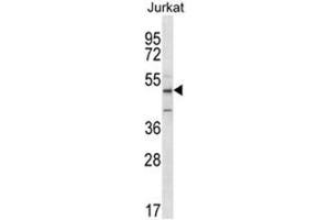 ABI2 Antibody (N-term) western blot analysis in Jurkat cell line lysates (35 µg/lane). (ABI2 Antikörper  (N-Term))