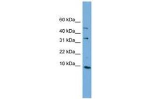 Image no. 1 for anti-Chromosome 16 Open Reading Frame 61 (C16orf61) (C-Term) antibody (ABIN6744182) (C16orf61 Antikörper  (C-Term))