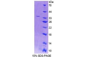 SDS-PAGE (SDS) image for Carboxylesterase 1 (CES1) (AA 19-300) protein (His tag) (ABIN6236864) (CES1 Protein (AA 19-300) (His tag))