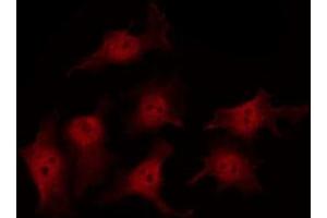 Immunofluorescence (fixed cells) (IF/ICC) image for anti-Junction Plakoglobin (JUP) (C-Term) antibody (ABIN6260497)