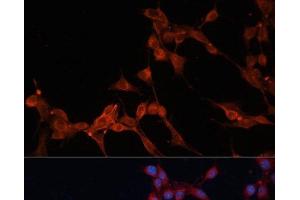 Immunofluorescence analysis of NIH/3T3 cells using SLC25A38 Polyclonal Antibody at dilution of 1:100. (SLC25A38 Antikörper)