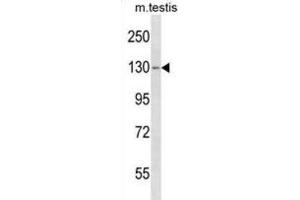 Western Blotting (WB) image for anti-TBC1 Domain Family, Member 2 (TBC1D2) antibody (ABIN5019936) (TBC1D2 Antikörper)