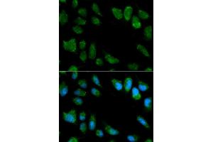 Immunofluorescence analysis of MCF7 cell using IL1RN antibody. (IL1RN Antikörper)