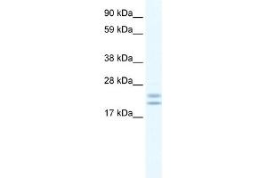 WB Suggested Anti-Tppp Antibody Titration:  0. (Tppp Antikörper  (C-Term))