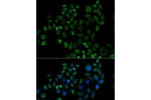 Immunofluorescence analysis of HeLa cells using FABP2 Polyclonal Antibody (FABP2 Antikörper)
