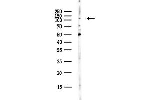 Western blot analysis of lysates from EC304 cells(LPS,4h treatment), using OGT Antibody at 1/1000 dilution.