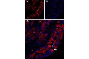 Expression of TRPV1 in rat DRGsImmunohistochemical staining of TRPV1 in rat dorsal root ganglion (DRG) using Guinea pig Anti-TRPV1 (VR1) Antibody (ABIN7043840, ABIN7045432 and ABIN7045433), (1:200).
