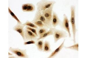 ICC testing of A549 cells (BUB3 Antikörper  (Middle Region))
