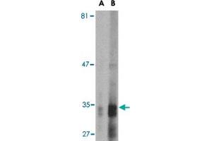 Western blot analysis of ENDOG expression in HepG2 cell lysate with ENDOG monoclonal antibody, clone 7G1C10  at (A) 2. (Endonuclease G Antikörper  (AA 76-170))