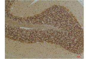 Immunohistochemical analysis of paraffin-embedded Human BrainTissue using KCNN2(SK2) Rabbit pAb diluted at 1:200. (KCNN2 Antikörper)