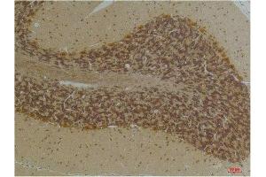 Immunohistochemical analysis of paraffin-embedded Human BrainTissue using KCNN2(SK2) Rabbit pAb diluted at 1:200.