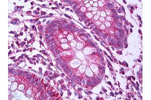 Anti-PHB / Prohibitin antibody IHC of human colon. (Prohibitin Antikörper)