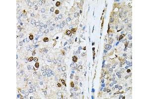 Immunohistochemistry (Paraffin-embedded Sections) (IHC (p)) image for anti-Polynucleotide Kinase 3'-Phosphatase (PNKP) antibody (ABIN7262583)