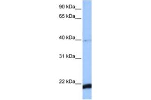 Western Blotting (WB) image for anti-HBS1-Like (HBS1L) antibody (ABIN2463501) (HBS1L Antikörper)