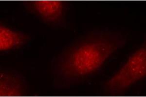 Immunofluorescence staining of methanol-fixed Hela cells, using Phospho-RB1-S780 antibody. (Retinoblastoma 1 Antikörper  (pSer780))