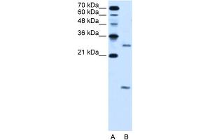 WB Suggested Anti-VMA21 Antibody Titration:  5. (VMA21 Antikörper  (N-Term))