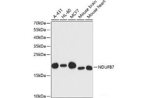 Western blot analysis of extracts of various cell lines using NDUFB7 Polyclonal Antibody at dilution of 1:3000. (NDUFB7 Antikörper)