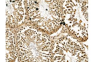 ABIN7094465 and ABIN7098513 at 1/100 staining Rat testis tissue by IHC-P.