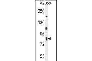 C6orf70 Antibody (Center) (ABIN654987 and ABIN2844625) western blot analysis in  cell line lysates (35 μg/lane). (C6orf70 Antikörper  (AA 346-375))