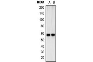 Western blot analysis of SHCB expression in Jurkat (A), NIH3T3 (B) whole cell lysates. (SHC2 Antikörper  (Center))