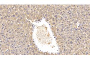 Detection of LCAT in Mouse Liver Tissue using Polyclonal Antibody to Lecithin Cholesterol Acyltransferase (LCAT) (LCAT Antikörper  (AA 290-432))