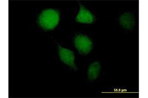 Immunofluorescence of purified MaxPab antibody to OGG1 on HeLa cell. (OGG1 Antikörper  (AA 1-324))
